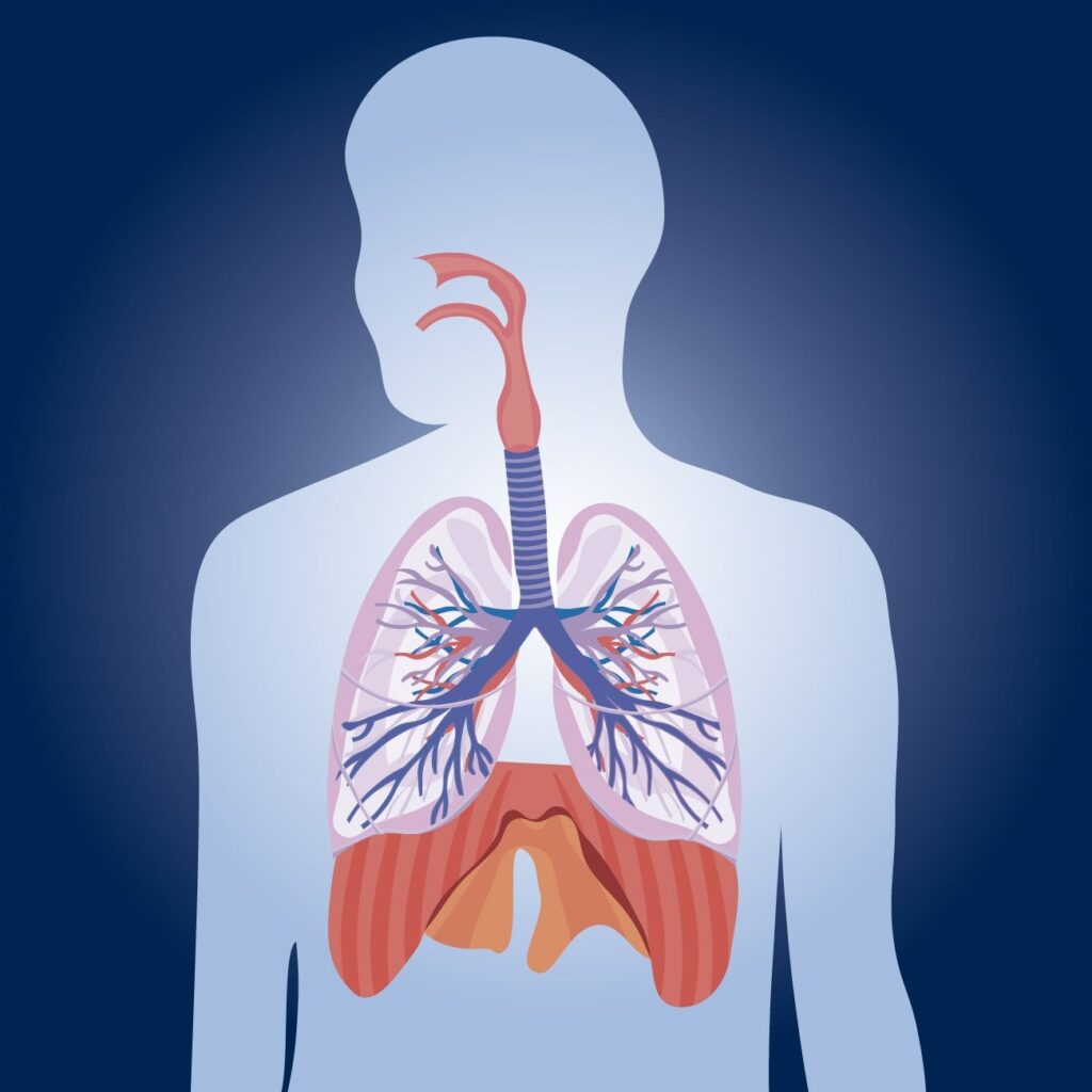Chronic bronchitis